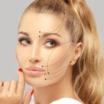 viso lifting